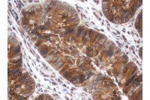 Image no. 3 for anti-Signal Recognition Particle Receptor, B Subunit (SRPRB) antibody (ABIN1501128) (SRPRB antibody)