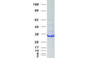 Western Blotting (WB) image for Excision Repair Cross Complementing Polypeptide-1 (ERCC1) (Transcript Variant 2) protein (Myc-DYKDDDDK Tag) (ABIN2720416)