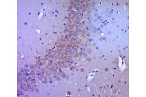 Immunohistochemistry (Paraffin-embedded Sections) (IHC (p)) image for anti-Discs, Large Homolog 4 (Drosophila) (DLG4) (AA 351-450) antibody (ABIN5001294)