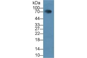 Detection of HCAM in Rat Serum using Polyclonal Antibody to Homing Associated Cell Adhesion Molecule (HCAM) (HCAM antibody  (AA 24-182))