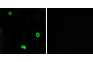 Immunofluorescence analysis of LOVO cells, using R4 antibody. (F2RL3 antibody)