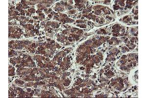 Image no. 2 for anti-Prefoldin Subunit 3 (PFDN3) antibody (ABIN1501704) (VBP1 antibody)