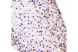 Fgfr1 antibody immunohistochemistry analysis in formalin fixed and paraffin embedded mouse adrenal glands. (FGFR1 antibody  (AA 756-784))