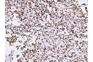 IHC analysis of PHF21A using anti-PHF21A antibody (ABIN6719353). (PHF21A antibody  (AA 1-97))