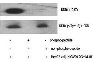 Western Blotting (WB) image for anti-Discoidin Domain Receptor tyrosine Kinase 1 (DDR1) (pTyr513) antibody (ABIN3182685) (DDR1 antibody  (pTyr513))