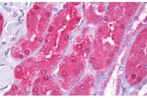 Anti-HIP1 antibody IHC staining of human kidney, tubules. (HIP1 antibody  (AA 928-1038))