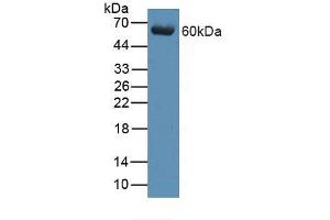 Figure. (beta Arrestin 1 antibody  (AA 3-246))