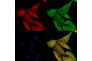Phospho-SIK2 (Ser343) Antibody staining A549 cells(H2O2 treatment) by IF/ICC.