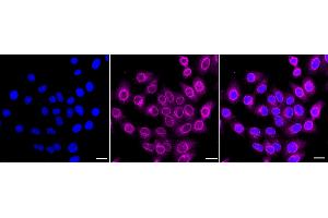 anti-Nucleoporin 62kDa (NUP62) antibody