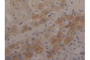 Immunohistochemistry (IHC) image for anti-Keratin 18 (KRT18) (AA 238-396) antibody (ABIN7433288)