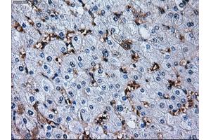 Immunohistochemical staining of paraffin-embedded liver tissue using anti-RPA2 mouse monoclonal antibody. (RPA2 antibody)