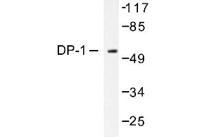 Image no. 1 for anti-Transcription Factor Dp-1 (TFDP1) antibody (ABIN265387) (DP1 antibody)