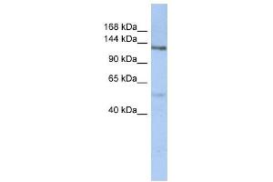 CHSY2 antibody used at 1 ug/ml to detect target protein. (CHPF antibody  (N-Term))