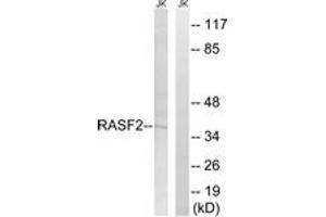 Western Blotting (WB) image for anti-Ras Association (RalGDS/AF-6) Domain Family Member 2 (RASSF2) (AA 109-158) antibody (ABIN2890568) (RASSF2 antibody  (AA 109-158))