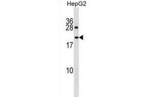 Western Blotting (WB) image for anti-Peptidylprolyl Isomerase A (Cyclophilin A)-Like 4A (PPIAL4A) antibody (ABIN3001342)