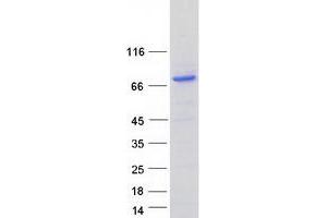 SARM1 Protein (Myc-DYKDDDDK Tag)