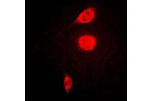 Immunofluorescent analysis of ATF1 staining in KNRK cells. (AFT1 antibody  (C-Term))