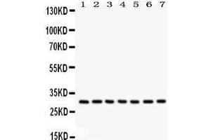 Anti- NQO1 Picoband antibody, Western blotting All lanes: Anti NQO1  at 0. (NQO1 antibody  (C-Term))