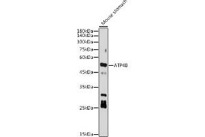 ATP4b antibody