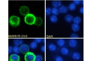Immunofluorescence staining of fixed mouse splenocytes with anti-CD27 antibody LG. (Recombinant CD27 antibody)