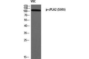Western Blot (WB) analysis of VEC using p-cPLA2 (S505) antibody. (PLA2G4A antibody  (pSer505))