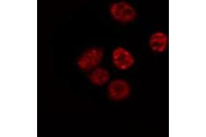 ABIN6267564 staining Hela by IF/ICC. (Histone H4 antibody  (acLys5))