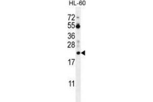Western blot analysis in HL-60 cell line lysates (35ug/lane) using Prothymosin alpha Antibody (N-term). (PTMA antibody  (N-Term))