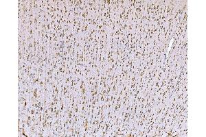 IHC analysis of SND1 using anti-SND1 antibody (ABIN7600526).