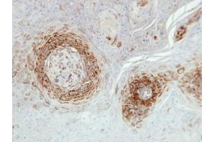 Immunohistochemistry (IHC) image for anti-NADH Dehydrogenase (Ubiquinone) 1 alpha Subcomplex, 5, 13kDa (NDUFA5) (full length) antibody (ABIN2856783)