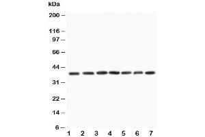 Western blot testing of MEK3 antibody and Lane 1:  rat skeletal muscle (MAP2K3 antibody  (N-Term))