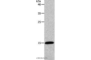 Western blot analysis of Human fetal brain tissue, using PFN2 Polyclonal Antibody at dilution of 1:450