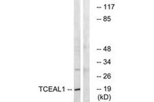 Western blot analysis of extracts from COLO cells, using TCEAL1 Antibody. (TCEAL1 antibody  (AA 91-140))