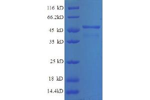 SDS-PAGE (SDS) image for Breast Cancer Metastasis Suppressor 1 (BRMS1) (AA 1-235), (partial) protein (GST tag) (ABIN5712363) (BRMS1 Protein (AA 1-235, partial) (GST tag))