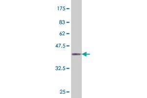 Western Blot detection against Immunogen (37. (HHEX antibody  (AA 133-237))