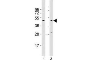 Western blot testing of CCR1 antibody at 1:2000 dilution. (CCR1 antibody  (AA 13-44))