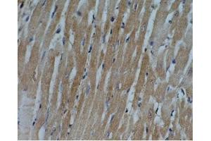 Rat heart tissue was stained by Anti-Adipo R1 (357-375) (Human) Antiserum (Adiponectin Receptor 1 antibody  (AA 357-375))