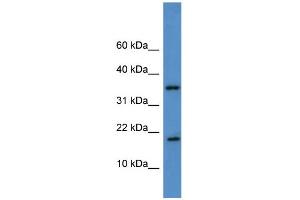 WB Suggested Anti-WBP5 Antibody Titration: 0. (WW Domain Binding Protein 5 (WBP5) (Middle Region) antibody)