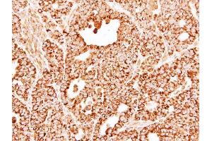 IHC-P Image Immunohistochemical analysis of paraffin-embedded NCI-N87 xenograft, using DECR1, antibody at 1:500 dilution. (DECR1 antibody)