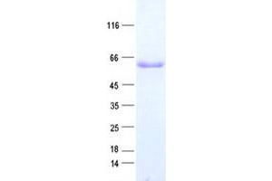 Western Blotting (WB) image for Transducin (Beta)-Like 1X-Linked (TBL1X) protein (His tag) (ABIN2733298)