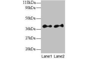 Western blot All lanes: SCAMP3 antibody at 2 μg/mL Lane 1: EC109 whole cell lysate Lane 2: 293T whole cell lysate Secondary Goat polyclonal to rabbit IgG at 1/15000 dilution Predicted band size: 39, 36 kDa Observed band size: 39 kDa (SCAMP3 antibody  (AA 2-170))
