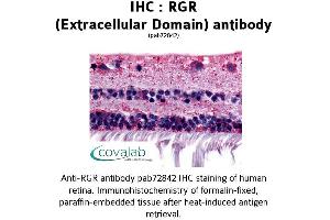Image no. 1 for anti-Retinal G Protein Coupled Receptor (RGR) (1st Extracellular Domain) antibody (ABIN1738846)
