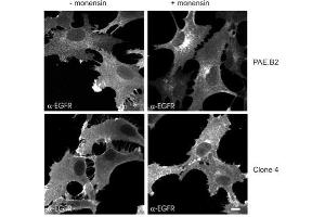 Immunofluorescently labelled cells with sheep anti-EGFR. (EGFR antibody)