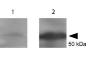 Western blot using  Anti-tetanus toxin C antibody shows detection of a protein band at 52 kDa corresponding to full length 6X HIS-TTFC fusion protein (arrowhead). (Tetanus Toxin C-Fragment (TTC) antibody)