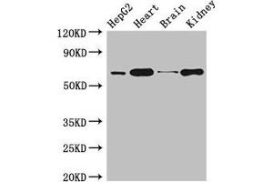 Western Blot Positive WB detected in: HepG2 whole cell lysate, Mouse heart tissue, Mouse brain tissue, Mouse kidney tissue All lanes: HNRNPL antibody at 3 μg/mL Secondary Goat polyclonal to rabbit IgG at 1/50000 dilution Predicted band size: 65, 51 kDa Observed band size: 65 kDa (HNRNPL antibody  (AA 89-335))
