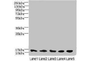 Western blot All lanes: TIMM10B antibody at 4 μg/mL Lane 1: Hela whole cell lysate Lane 2: 293T whole cell lysate Lane 3: HepG2 whole cell lysate Lane 4: K562 whole cell lysate Lane 5: Mouse heart tissue Secondary Goat polyclonal to rabbit IgG at 1/10000 dilution Predicted band size: 12 kDa Observed band size: 12 kDa (TIMM1B (AA 1-103) antibody)