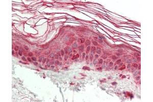 Human Skin: Formalin-Fixed, Paraffin-Embedded (FFPE). (Hairless antibody  (AA 697-746))