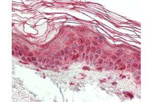 Human Skin: Formalin-Fixed, Paraffin-Embedded (FFPE).