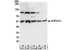 Western Blotting (WB) image for anti-ATPase, H+ Transporting, Lysosomal 50/57kDa, V1 Subunit H (ATP6V1H) (AA 400-450) antibody (ABIN7450975)