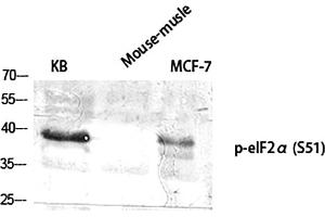 Western Blot analysis of KB (1), mouse-musle (2), MCF-7 (3), diluted at 1:2000. (EIF2A antibody  (pSer51))
