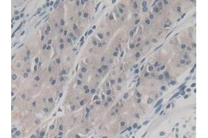 Detection of NGAL in Human Stomach Tissue using Monoclonal Antibody to Neutrophil gelatinase-associated lipocalin (NGAL) (Lipocalin 2 antibody  (AA 21-198))